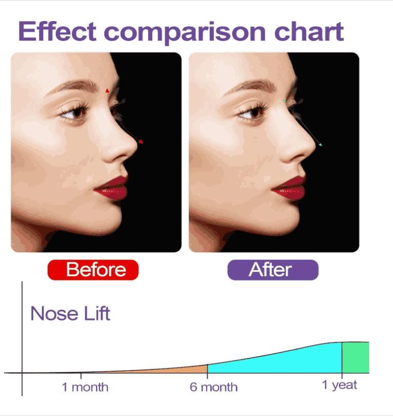 Nose Up Clip High Lifting Clipper Correction For Shaping Nose Tool